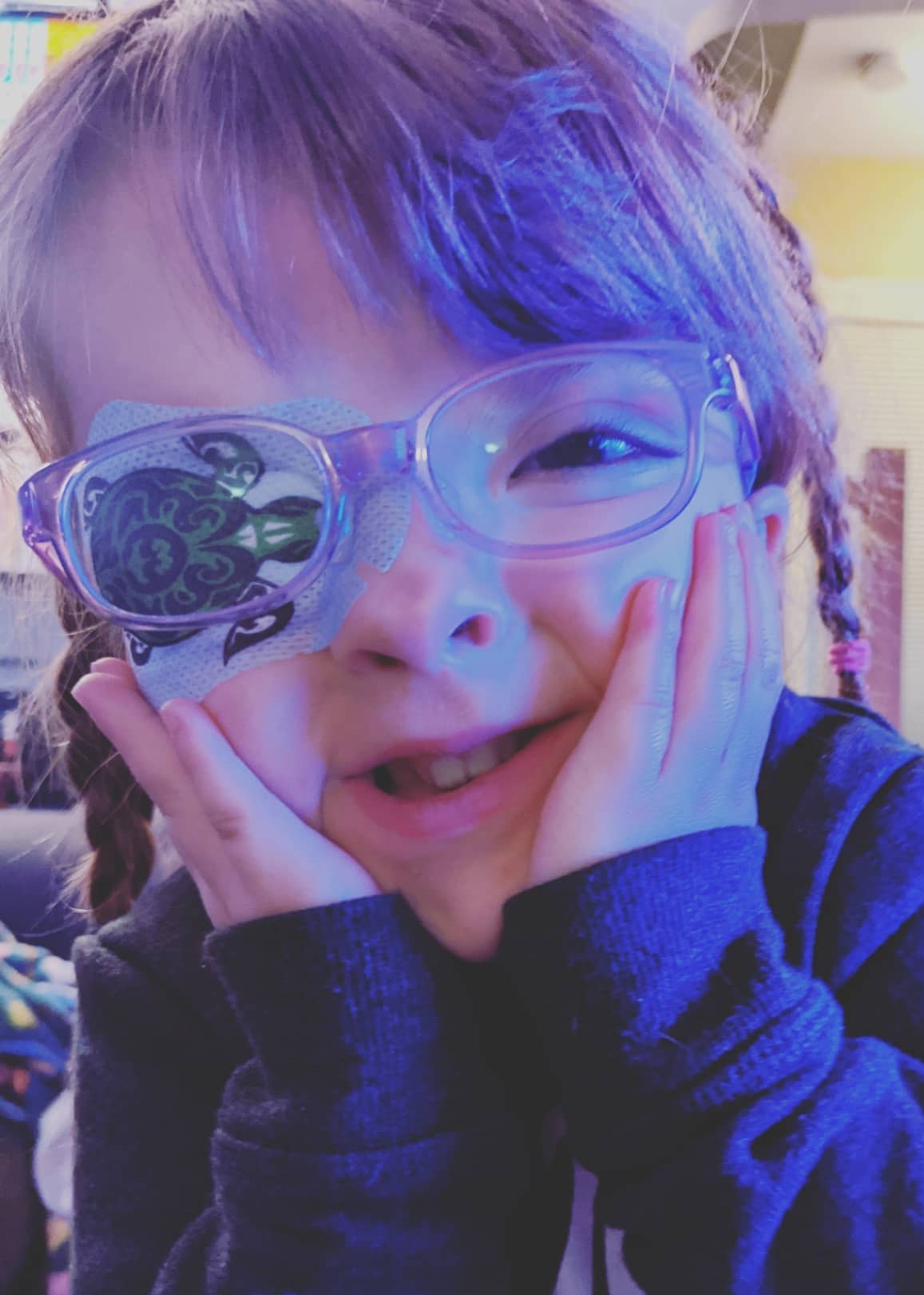 Little girl with braided pigtails, pink glasses, and a turtle patch on her right eye. She has a hand on each of her cheeks and she is smiling happily at the camera. 